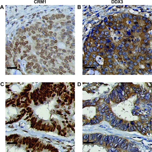 Figure 2 The subcellular localization of CRM1 correlates with the subcellular location of DDX3.