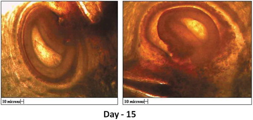 Figure 9. Hand cut sections showing parthenocarpic development of seed on 15th day after anthesis (All scales 10µ).