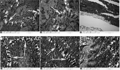 Figure 7. Scanning electron micrographs show intercellular junctions. In the reconstructed tissue, many desmosomes formed between cells (A, B), but no half-desmosomes formed between the cells and the basal layer (C). Desmosomes are shown between cells in normal oral mucosal epithelium (D, E), and half-desmosomes occur between cells and the basal lamina (F).
