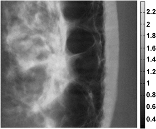 Figure 1. Estimation of soft tissue mass density for a woman’s breast in units of g cm−2 Citation18.