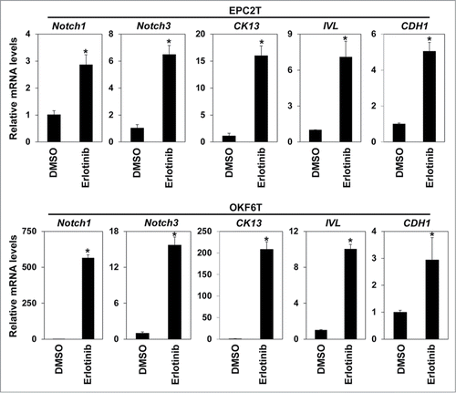 Figure 3. Erlotinib upregulated Notch transcriptional factors and induced differentiation. EPC2T cells and OKF6T cells were treated with erlotinib (2.5 μM) for 72 hours and expression levels of indicated genes were determined by real-time RT-PCR. Notch1 and Notch3 are critical transcriptional factors in keratinocyte differentiation. CK13 and involucrin (IVL) are differentiation markers of keratinocytes. (* P < 0.05 vs. DMSO control)