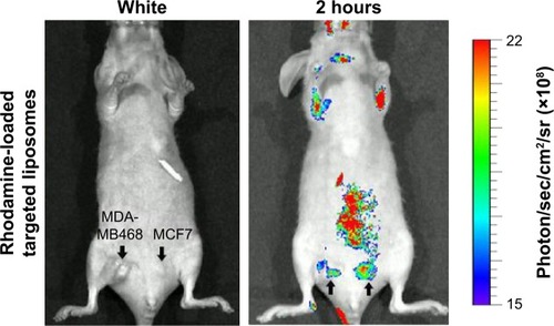 Figure 8 In vivo cancer targeting of targeted liposomes.Notes: Mice bearing established MDA-MB468 and MCF7 tumors were injected with 500 μM rhodamine-loaded targeted liposomes. Fluorescence intensity in mice recorded on a noninvasive in vivo imaging system (IVIS) 2 hours after injection.