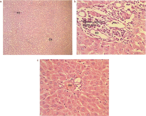 Figure 1.  (a) Low power (HE, × 100) and (b, c) high power (HE, × 400) photomicrographs of liver. Sample from control (a) shows normal hepatic parenchyma with portal triad (PT), central vein (CV), and hepatocytes. In the case of compound 4a (b), liver shows hepatic parenchyma with inflammatory cells infiltrating the portal triad (PT). The central vein and hepatocytes do not show any inflammatory cells. BD, Biliary duct. In the case of compound 4o (c), liver shows normal portal triad structures.