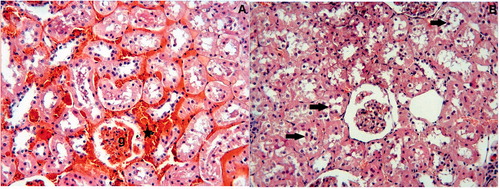 Figure 2. I/R Group: (A) Glomeruli (g) are hypocellularity and shrinkage. Interstitial hemorrhage is evident (asterisks). (B) Desquamated epithelial cells are visible in the lumens of tubules (arrows). H–E;X66.