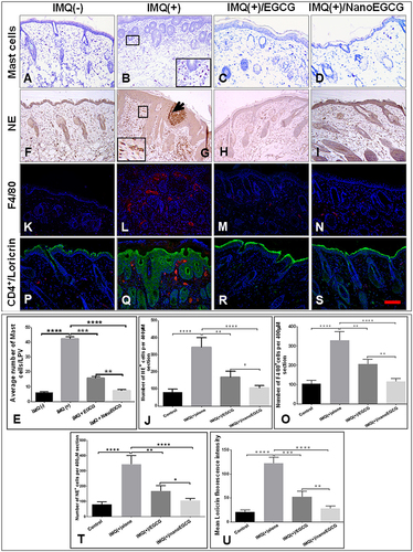 Figure 5 Effect of topically applied free EGCG and nanoEGCG on infiltrating immune cells and expression of differentiation markers in IMQ-treated mouse skin lesions: Mice were treated in 4 groups as described in the legends to Figure 4 and Figure S5. (A–D, F–I, K–N, P–S) Photomicrographs showing immunohistological features of: (A–D) mast cells (toluidine blue staining); (F–I) epidermis/dermis (NE, brown staining), and microabscesses (arrow); (K–N) macrophages (F4/80, red staining); and (P–S) double immunofluorescence staining for loricrin (green) and T-lymphocytes (CD4+, red staining). Nuclei were counterstained blue with DAPI. Magnification for all panels ×200. (E, J, O, T, U) Quantitative analyses of changes in immune cells: (E) mast cells; (J) NE+ cells; (O) F4/80+ cells; and (U) loricrin in the 4 treatment groups. Each data point represents the mean±SD of 4 random fields/mouse from 5 mice/group. *p, 0.05, **p, 0.01, ***p, 0.001, and ****p, 0.0001 for the indicated 2-way comparisons.