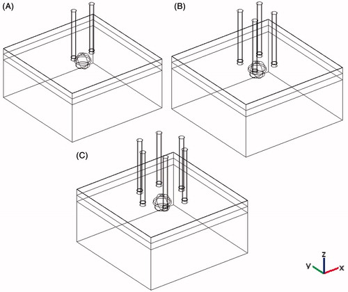 Figure 2. 3D configurations of different electrode geometry with respect to tumour and a four-layer skin model. (A) 2-electrode geometry, (B) 4-electrode geometry, (C) hexagonal geometry.