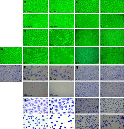 Figure 3 Morphological characteristics of HECs (microscope and Giemsa staining). (A) Control group; (B and F) sodium morrhuate group; (C and G) blank liposome group; (D and H) liposomal sodium morrhuate group; (E and I) sodium morrhuate immunoliposome group. Scale bars =50 μm.Abbreviation: HEC, hemangioma endothelial cell.