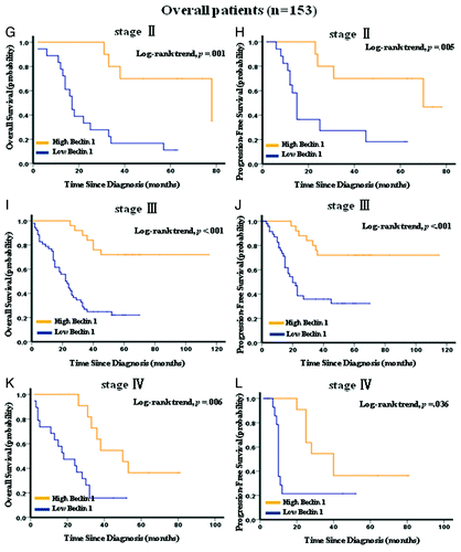 Figure 4G–L. Kaplan–Meier survival analysis of Beclin 1 expression in subsets of gastric cancer patients with stage II, III and IV. (G) Probability of overall survival and (H) progression-free survival of gastric cancer patients with stage II in the overall patients: low expression, n = 18; high expression, n = 10. (I) Probability of overall survival and (J) progression-free survival of gastric cancer patients with stage III in the overall patients: low expression, n = 52; high expression, n = 25. (K) Probability of overall survival and (L) progression-free survival of gastric cancer patients with stage IV in the overall patients: low expression, n = 19; high expression, n = 11.