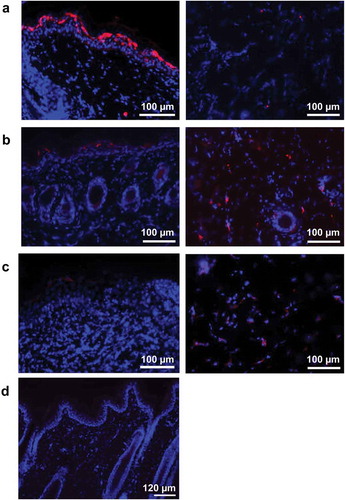 Figure 1. Intradermal pLASV-GPC vaccine antigen expression following ID-EP delivery. Guinea pigs were immunized intradermally with pLASV-GPC DNA vaccine (a–c) or empty vector (d) by ID-EP delivery. Skin tissue samples were collected at 24 (a,d), 48 (b), or 72 (c) hours post-immunization for antigen expression (red) and epidermis (left panel) and dermis (right panel) were imaged by fluorescent microscopy. Red indicates LASV GPC staining and blue indicates Hoechst counterstaining of nuclei.