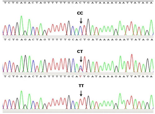 Figure 2. Sequence chromatogram of different genotypes at C472T SNP locus identified in intron-1 region of TLR4 gene.