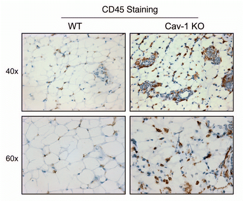 Figure 6 Cav-1 (−/−) mammary fat pads show the upregulation of CD45(+) cells. Mammary fat pads from wild-type (WT) and Cav-1 (−/−) null mice were harvested and processed for immuno-staining. Note that Cav-1 (−/−) null mammary fat pads show the upregulation of CD45(+) cells, consistent with lymphocytic infiltration. Original magnifications, 40x and 60x.
