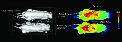 Figure 4 Surface rendering (left panel) and signal enhancement images (right panel) of the same pair of mice bearing KB tumors (upper flank of mouse) and MCA207 tumors (lower flank of mouse) injected with folate-targeted contrast nanoparticle (A) and non-targeted contrast nanoparticle (B). The KB tumor that expresses FAR showed signal enhancement at 24 hours post-injection of targeted-contrast (right panel, A, upper flank) compared with some capture in MCA207 tumor, which was non-specific for both targeted and non-targeted contrast nanoparticles.