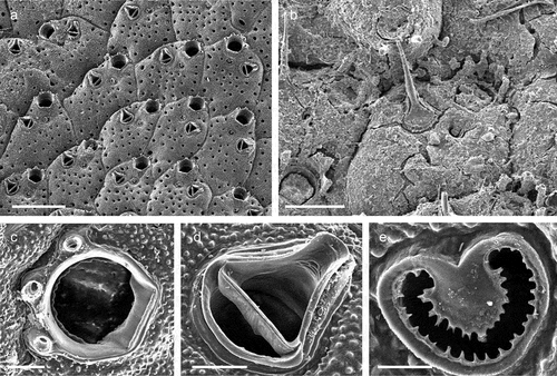 Figure 33. Microporella verrucosa. (a) Autozooids in the encrusting part of the colony. (b) Mandible of the avicularium. (c) Orifice. (d) Avicularium. (e) Ascopore. Scales: (a) 500 µm; (b) 200 µm; (c, d) 50 µm; (e) 200 µm.
