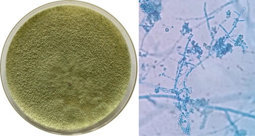 Figure 2. Morphological characteristics and spore morphology of Trichoderma reesei S12 observed under microscope (OLYMPUS CX21FS1, 400×).