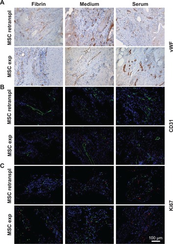 Figure 3 Vascularization of the explants and cell proliferation.Notes: Staining against vWF (brown) (A) and CD31 (green) (B) of sections in the 4-week group revealed a dense vascular network nearly all over the explants. For retrieval of implanted MSC, the cells were labeled using DiI (red staining) before implantation. DiI-labeled cells could be detected mainly in the groups with expanded MSC. (C) To establish viability and active proliferation of the transplanted cells, Ki67 (green) staining was performed, demonstrating proliferation of cells in all constructs to a comparable extent.Abbreviations: exp, expanded; retranspl, retransplanted; MSC, mesenchymal stem cells; vWF, von Willebrand factor; DiI, dioctadecyl-3,3,3′3′-tetramethylindocarbocyanine perchlorate.