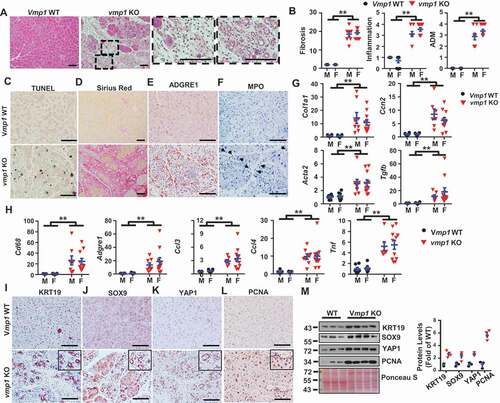 Figure 3. Loss of acinar cell VMP1 induces spontaneous pancreatitis reminiscent of chronic pancreatitis. Two-months old male and female Tg(Cela1-cre/ERT)/BAC-Ela-Cre−; Vmp1f/f (Vmp1 WT) and Tg(Cela1-cre/ERT)/BAC-Ela-cre+; vmp1f/f (vmp1 KO) mice were injected with tamoxifen (75 mg/kg) once a day for consecutive 3 days, and these mice were sacrificed 5 days after the last injection of tamoxifen. (A) Representative images of H&E staining are shown. Bar: 100 µm. (B) Individual histology score of H&E staining was graded. M: male; F: female. Data are mean ± SE (n = 5–11). **p < 0.01; Student t-test analysis. Representative images of (C) TUNEL, (D) Sirius red, (E) ADGRE1/F4/80, and (F) MPO staining are shown. Bar: 100 µm. Pancreatic mRNA was extracted followed by qPCR analysis for fibrotic genes (G) and inflammation genes (H). Results were normalized to Rpl13a and expressed as fold change compared to Vmp1 WT group. Data shown are mean ± SE (n = 6–11). **p < 0,01; Student t-test analysis. Representative images of (I) KRT19, (J) SOX9, (K) YAP1, and (L) PCNA IHC staining are shown. Scale bars: 100 µm. (M) Immunoblotting analysis using total lysates from pancreatic tissues followed by densitometry analysis. Data are normalized to WT and are mean ± SE (n = 3–4).