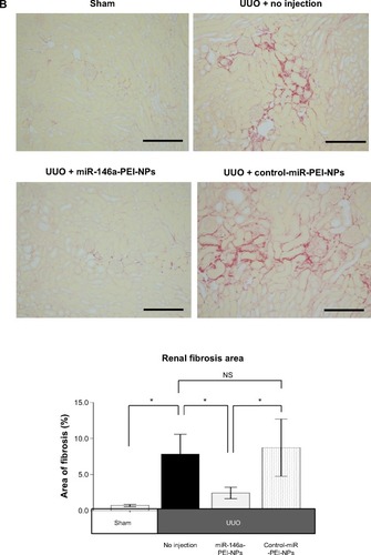 Figure 5 Effects of microRNA (miR)-146a-polyethylenimine nanoparticles (PEI-NPs) on fibrotic changes in obstructed kidneys.Notes: (A) Representative azan staining of obstructed kidney sections in each group (n=6). Areas with positive blue staining show collagen fibers. (B) Representative sirius red staining of obstructed kidney sections and quantitative analysis of fibrotic areas in each group (n=6). Values are mean ± standard error (error bars). *P<0.05. Scale bar 100 μm.Abbreviations: NS, not significant; UUO, unilateral ureteral obstruction.