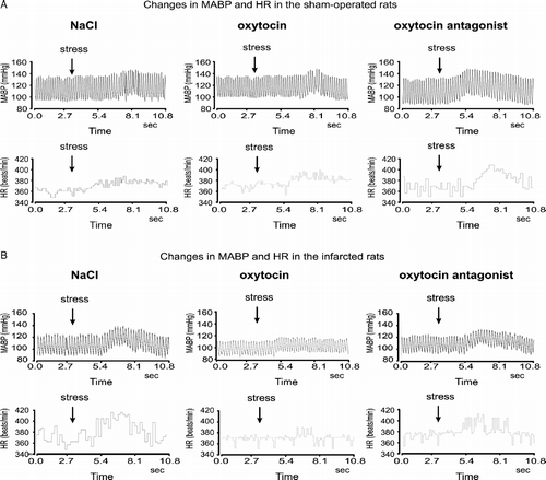 Figure 2  Representative illustrations of changes in MABP and HR after application of the air jet stressor (arrow) in the sham-operated and infarcted rats during ICV infusion of 0.9% NaCl, OXY or OXYANT. The Figure shows that (1) during infusion of 0.9% NaCl MABP and HR responses to stress are markedly greater in the infarcted than in the sham-operated rat, (2) ICV administration of OXYANT intensifies MABP and HR responses to stress in the sham-operated but not in the infarcted rat and (3) ICV administered OXY reduces MABP and HR responses to stress in the infarcted but not in the sham-operated rat.