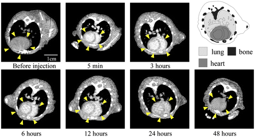 Figure 3. Change in CT value of a heart slice before and after injection of 30-nm Au-PEG. Yellow arrowheads indicate the region of the heart.