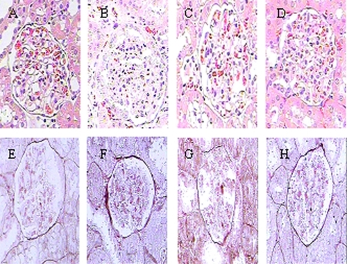Figure 3 Effect of HMP on renal pathological parameters with the use of HE (A–D) and PASM (E–H) stained kidney sections in SHR. A and E refer to WKY rats; B and F refer to SHR; C and G refer to HMP low dosage group; D and H refer to HMP high dosage group.