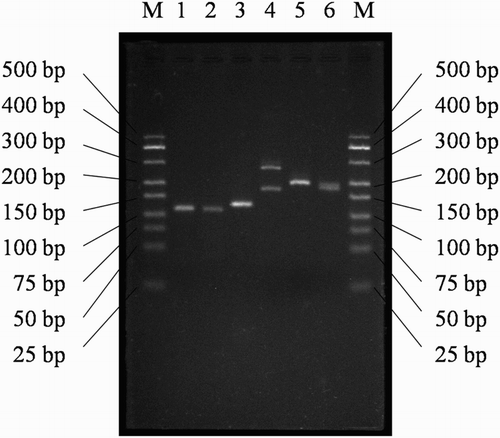 Figure 1. Electrophoresis spectra of DNA marker and RTFQ-PCR products of endogenous reference gene (β-actin) and target genes (IL-2, CD4, CD8, IL-10 and IFN-γ). Channel M: DNA marker; Channel 1: IL-2 (about 120 bp); Channel 2: CD4 (about 115 bp); Channel 3: CD8 (about 130 bp); Channel 4: β-actin (about 275 bp and 175 bp); Channel 5: IL-10 (about 200 bp); Channel 6: IFN-γ (about 180 bp).