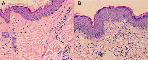 Figure 2 (A) Back. (B) Legs.