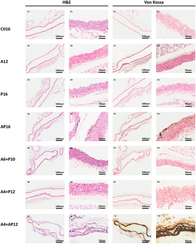 Figure 6. Representative histopathological images in thoracic aorta tissues from different groups. Thoracic aorta tissues were evaluated in each group using hematoxylin and eosin (H&E) (A1–7, B1–7), and von Kossa (C1–7, D1–7).