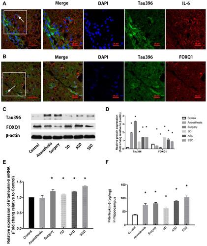 Figure 3 Changes in tau, FOXQ1 and IL-6 after different interventions. (A) Representative fluorescence images showing the distributions of IL-6 (red), Tau396 (green) and nuclei (blue) in the hippocampus of a rat in the SSD group. (B) Representative fluorescence images showing the distributions of FOXQ1 (red), Tau396 (green) and nuclei (blue) in the hippocampus of a rat in the SSD group. (C) Representative Western blots showing Tau396 and FOXQ1 expression. Actin was used as a loading control. (D) Quantification of the relative protein expression of tau396 (*F=4438.580, P <0.001 versus the Control group) and FOXQ1 in the 6 groups (*F=108.506, P <0.001 versus the Control group) (n=6). (E) Quantification of the relative plasma mRNA expression of IL-6 in all groups by RT-PCR, *F=34.943, P = 0.02 versus the Control group. (F) Quantification of hippocampal IL-6 by ELISA, *P < 0.001 versus the Control group. Data are expressed as the mean ± SD.