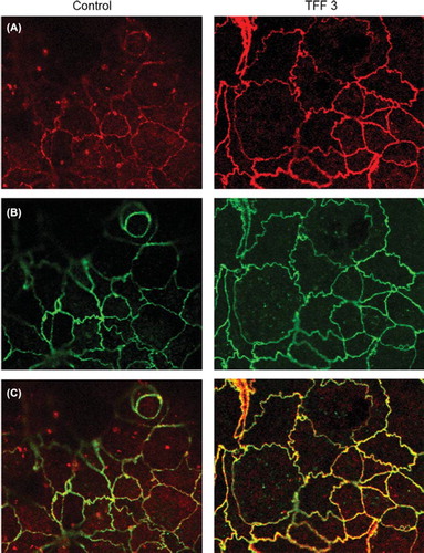 Figure 2. Expression and subcellular localisation of ZO-1 and occludin in unstimulated and TFF3-treated Caco-2 monolayers by confocal microscopy. (A) and (B) show ZO-1 (red) and occludin (green) immunolabelling. (C) shows an overlay of the two channels revealing co-localisation (yellow) of ZO-1 and occludin proteins at the cell membrane and cytoplasmic ZO-1 staining (magnification × 500). Compared to control, treated cells showed a greater degree of co-localisation (yellow) and a relocation of ZO-1 from the cytoplasmic to the cell membrane compartment.