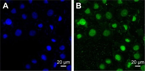 Figure 5 Confocal laser scanning microscopy images of HepG2 cells after 4-hour incubation with OA-MVLs (160 μmol/L).Notes: (A) Nucleus staining by DAPI (blue). (B) OA-MVLs labeled by green fluorescence (green). Magnification =200×.Abbreviations: OA-MVLs, oleanolic acid-encapsulated multivesicular liposomes; DAPI, 4′,6-diamidino-2-phenylindole.