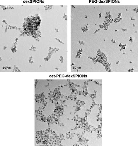 Figure S2 Transmission electron micrographs of dexSPIONs, PEG-dexSPIONs, and cet-PEG-dexSPIONs. The average size of particles estimated from the transmission electron images was about 10–20 nm. Scale bar, 50 nm.Abbreviations: cet, cetuximab; dex, dextran; PEG, polyethylene glycol; SPIONs, superparamagnetic iron oxide nanoparticles.