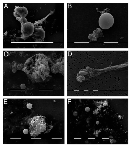 Figure 4. SEM of BCG cultures after starvation stress: BCG-BG – (A), (E), (F) and BCG-D- (B), (C), (D). Typical L-form cells: spherical large bodies (A) and (B) giant “mother” cells (C) and (E), elongated forms (A) and (D), small elementary bodies and granules (C), (E) and (F). Bar = 100 µm (A); 10 µm (b, c, e, f); 1 µm (D)
