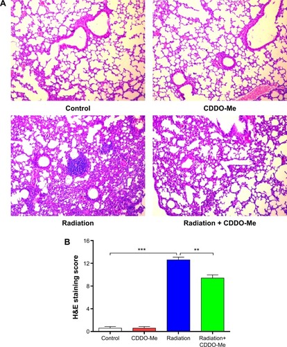 Figure 3 Effects of CDDO-Me treatment on histopathological changes in lung tissues of radiation-treated mice.