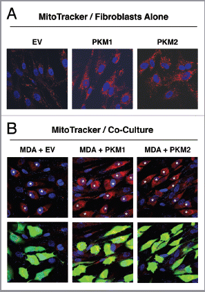 Figure 6 Fibroblasts overexpressing PKM1 and PKM2 promote mitochondrial activity in adjacent cancer cells. MitoTracker staining was used to visualize mitochondrial activity in homotypic cultures and in co-cultures of fibroblasts and GFP-positive MDA-MB-231 cells. DAPI was used to visualize nuclei (blue). (A) Fibroblast homotypic cultures. Note that fibroblasts expressing PKM1 or PKM2 exhibit high levels of MitoTracker staining (red) relative to empty vector (EV) control cells, consistent with increased mitochondrial activity. (B) Co-cultures. Note that fibroblasts expressing PKM1 or PKM2 increase the MitoTracker staining (red) of adjacent GFP-positive MDA-MB-231 cells (green), relative to empty vector (EV) control cells. In the top panels, only the red channel is shown, to appreciate the increased MitoTracker staining of cancer cells. The white stars identify the nuclei of GFP positive MDA-MB-231 cells. In addition, PKM1 and PKM2 fibroblasts co-cultured with cancer cells show reduced MitoTracker staining compared with respective homotypic cultures (compare panel A and B).