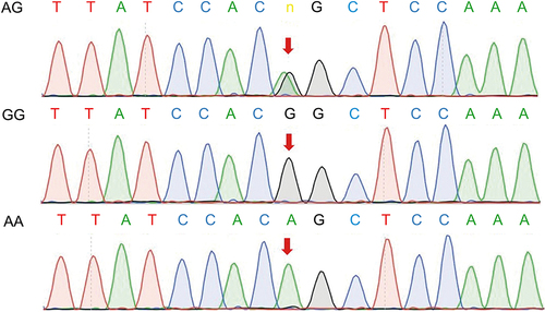 Figure 2 Sanger sequence map of AG, GG and AA at the rs3745367 locus in resistin.