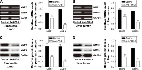 Figure 5 Inhibitory effects of anti-PD-L1 antibody on the invasion behavior of pancreatic tumor and spontaneous liver metastasis.