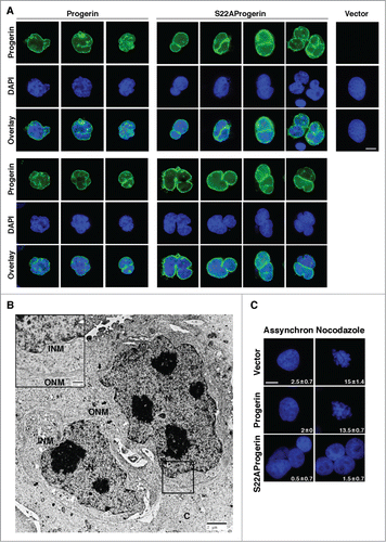 Figure 4. S22A-progerin expressing cells display invaginations of the nuclear envelope, nuclear fragmentation and a failure in chromosome condensation. (A) Immunofluorescence with a progerin specific antibody in U-2 OS cells expressing vector, progerin, or S22A-progerin. Magnification = 10 μm. (B) Electron microscopy showing a cell where a nuclear envelope invagination divides the nuclei in 2 fragments. The black arrows indicate the outer nuclear membrane (ONM) and the white arrows the inner nuclear membrane (INM). (C) Dapi staining of U-2 OS cells expressing vector, progerin, or S22A-progerin. The percent of cells with condensed chromosomes is indicated at the bottom right of each panel. Magnification = 10 μm.