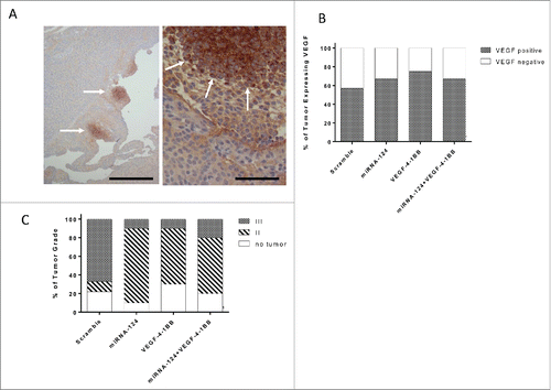 Figure 2. Glioma biology in the setting of miR-124 and VEGF-4–1BB treatment. (A). Representative VEGF staining of a high-grade glioma induced in Ntv-a mice transfected with RCAS-PDGFB and RCAS-STAT3 transgenes demonstrates an island of expression (left panel bar scale r = 12.5 μm ; right panel bar scale = 100 μm). Arrows denote localized areas of positive VEGF staining. (B). Summarized analysis of the presence of VEGF in the tumors of mice treated with scramble control (n = 7), miR-124 (n = 9), VEGF-4–1BB (n = 7), or miR-124 + VEGF-4–1BB (n = 9). (C). Summary graph demonstrates the incidence of high- and low-grade gliomas on the basis of hematoxylin and eosin staining features of necrosis and neovascular proliferation in Ntv-a mice transfected with RCAS-PDGFB and RCAS-STAT3 transgenes and subsequently treated with scramble control (n = 9), miR-124 (n = 10), VEGF-4–1BB (n = 10), or the combination of miR-124 + VEGF-4–1BB (n = 10) from Fig. 1A-B.