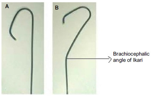 Figure 14 Comparison between the Ikari catheter and the Judkins left catheter.