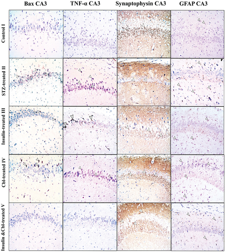 Figure 4. Photomicrographs of paraffin sections in CA3 region showing Bax, TNF-α, synaptophysin and GFAP immune reactions; Positive reactions (arrow heads) (Power × 100). According to Bax and TNF- α immunostains; Group I (control group) shows -ve immune reaction. Group II shows numerous +ve immunostained cells. Group III (insulin-treated group) and Group IV (Cbl-treated group) shhow a decrease in the number of immunoreactive cells and in Group V (insulin- and Cerebrolysin-treated group) almost all cells appear -ve immunostained. In synaptophysin stain, +ve reaction of presynaptic terminals is seen in the form of coarse beaded granules at surfaces of pyramidal cells and at their apical dendrites. Group II shows markedly decreased immunoreactivity. Group III and Group IV show a moderate decrease and Group V shows a marked decrease in number of labeled astrocytes.