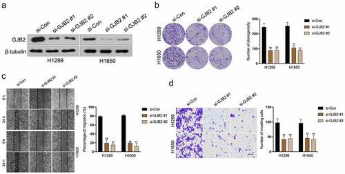 Figure 3. Deletion of GJB2 inhibits LUAD cells migration and invasion. a. H1299 and H1650 were transfected with si-GJB2 (#1 or #2). The expression of GJB2 was determined by Western blot. b. H1299 and H1650 were transfected with si-GJB2 (#1 or #2). The growth of LUAD cells was evaluated with a colony formation assay. c. Wound healing assay of GJB2 silencing H1299 and H1650 cell. d. Transwell invasion assay of GJB2 silencing H1299 and H1650 cell. Data represent the Mean ± SD for at least three independent experiments. **P< 0.01 compared with si-Con.