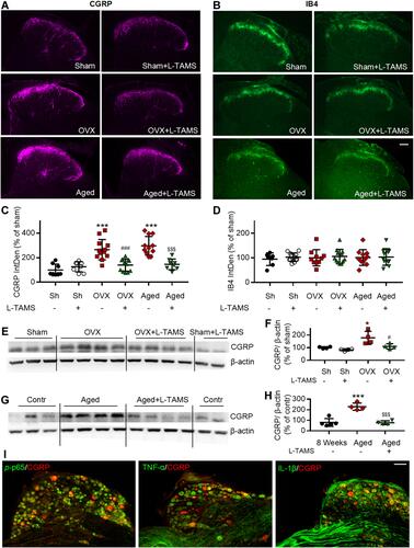 Figure 8 Oral application of L-TAMS prevents the CGRP increase in ovariectomized mice and reverses the CGRP increase in aged female mice in spinal dorsal horn. (A and B) Representative immunofluorescent staining images of CGRP (A) and IB4 (B) in spinal dorsal horn of different groups. Scale bar: 100 μm. (C and D) Oral application of L-TAMS significantly attenuates the CGRP sprouting in OVX and aged mice. There was no significant difference in the expression of IB4 among the groups (n = 3–4 mice/group, 2–3 sections/mouse). (E and F) Representative Western blots (E) and statistical analysis (F) show the CGRP levels in spinal dorsal horn in Sham, Sham + L-TAMS, OVX, and OVX+ L-TAMS groups (n = 4 per group). (G and H) Representative Western blots (G) and statistical analysis (H) show the CGRP levels in spinal dorsal horn in control (8 weeks), Aged and Aged + L-TAMS groups (n = 4–5 per group). The data were analyzed by one-way ANOVA with Tukey’s test. *P<0.05, ***P<0.001, vs Sham (Sh); #P<0.05, ###P<0.001, vs OVX; $$$P<0.001, vs Aged. (I) Double stainings show that CGRP is colocalized with p-p65, TNF-α and IL-1β in DRG neurons. Scale bar: 100 μm.