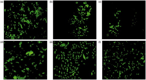Figure 6. Fluorescence micrographs of stained RINm5f cells with 5 μM NAO (a: control, b: 0.5% TSC treatment, c: 1% TSC treatment, d: 15 μg/ml SOE treated cells, e: 0.5% TSC + 15 μg/ml SOE treated group, f: 1% TSC + 15 μg/ml SOE-treated group).