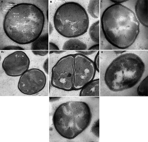 Figure 4. P. fluorescens grown in TSB culture medium of pH 6.4 (primary control) presented no alterations in their features and even distribution of cytoplasmic structures (A). Cells exposed to alkaline conditions of pH 8.2 (control for PAA and H2O2) presented less dispersed, more confined nucleoid and electrodense structures accumulation (B). Cells exposed to acidic environment of pH 5.0 (control for LAS) (C) showed empty appearing vacuoles and deformed membranes. Cells treated with LAS showed corrugated membranes, empty vacuoles and black cytoplasmic condensations (D1, D2). Bacteria treated with PAA showed cytoplasmic vacuolization, protein accumulation, asymmetric and damaged membranes (E). Cells treated with H2O2 showed cytoplasmic vacuoles, distinct alteration of cell components with electrodense structures, and membranous bleb-like bulge indicating cell damage (F). OM, outer membrane; PG, peptidoglycan; PP, periplasm; PM, plasma membrane; N, nucleoid; Cy, cytoplasm; R, ribosomes. Scale bar = 200 nm (A, B, C, D2, E, F), 500 nm (D1).