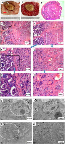 Figure 5. Pathologic images of the goat mammary gland after the JCQ-B transducer sonication. (a and b) macroscopic view of the ablated area before and after TTC staining. (c) a complete view of the ablated area and surrounding normal tissue with H&E staining (6.7×). (d and e) local magnification of (c) (white square, 40× and 100×, respectively). There was hyperemia and edema (H) between the coagulation area (C) and the normal tissue (N). (f-i) histological images of normal tissue (black square) (5f, 200× and 5h, 400×) and ablated tissue (white square) (5 g, 200× and 5i, 400×). (j-m), from (a) specimen, normal tissue (red arrow in a) and ablated tissue (white arrow in Citation5(a)) were taken. TEM images of normal tissue (5j, 6000× and 5 l, 12,000×) and ablated tissue were shown. (5k, 6000 × and 5 m, 10,000×).