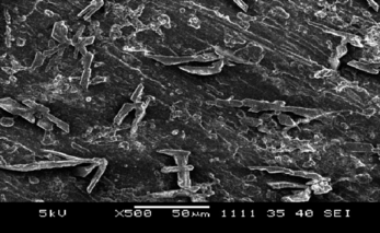 Figure 2 SEM of Pt/polypyrrole-ferrocenium-uricase.