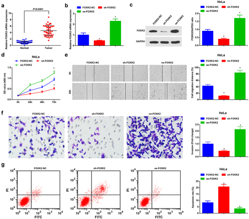 Figure 5. Inhibition of FOXK2 represses the development of CC cells. (a), FOXK2 expression in CC tissues and normal tissues (n = 45) was detected by RT-qPCR; (b/c), FOXK2 level after transfection with sh-FOXK2 or oe-FOXK2 was examined by RT-qPCR and Western blot assay; (d), cell proliferation after transfection with sh-FOXK2 or oe-FOXK2 was assessed by CCK-8 assay; (e), cell migration after transfection with sh-FOXK2 or oe-FOXK2 was detected by scratch test; (f), cell invasion after transfection with sh-FOXK2 or oe-FOXK2 was determined by Transwell assay; (g), cell apoptosis after transfection with sh-FOXK2 or oe-FOXK2 was assessed by flow cytometry. The data in the figure were all measurement data, and the values were represented by mean ± standard deviation, the t-test was used for the comparison between two groups; ANOVA was adopted for the comparison among multiple groups and Tukey’s post hoc test was used for pairwise comparisons after ANOVA; * P < 0.05 vs. the FOXK2-NC group.  the cell experiment was repeated at least three times independently.