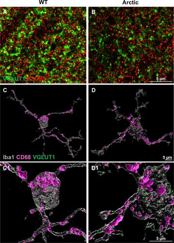 Figure 2 Excessive synaptic loss in a mouse model of Alzheimer’s disease. Representative superresolution images of double immunofluorescence for a presynaptic marker (VGLUT1, green) and postsynaptic marker (PSD95, red) in hippocampus from a WT (A) and an Arctic AD model mouse (B) showing the loss of presynapses at 10 months of age. Courtesy of Dr. Maria Fonseca. This synaptic loss could be due to an increase in complement mediated microglial phagocytosis, as shown by a 3D reconstruction of microglia (Iba1, gray), lysosomes (CD68, pink) and presynapses (VGLUT1, green). The Arctic mouse (D-D1) showed an increased VGLUT1 within the microglia, when compared to a WT littermate (C-C1). Scale bars, 5 μm. All animal procedures were approved by the Institutional Care and Use Committee of University of California Irvine.