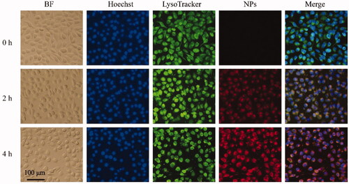 Figure 5. Representative fluorescent microcopy images of 4T1 cells incubated with HCPT/Ce6 NPs at Ce6 concentration of 5 µg/mL for different incubated times. Scar bar: 100 µm.