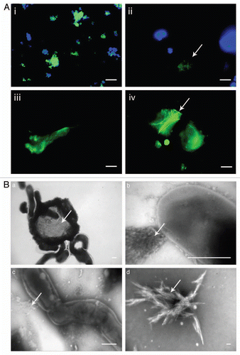 Figure 2 (A) Functional amyloid occurs in different species in different shapes and sizes. Antibody labeling using the amyloid-specific antibody WO1 is shown in green and nuclear counterstaining (DAPI) in blue. (i) C. glutamicum. FuBA is present around all cells. (ii) G. obscurus. FuBA occurs in large extracellular aggregates. The arrows indicate extracellular material with a high level of amyloid but low cell density. Bars 10 µm. (iii) M. avium. Velvet-like substances strongly bind WO2. (iv) T. spumae. Long (up to 50 µm) fibrils (arrows) are present. Bars 10 µm. (B) Saponification of G. amarae at increasing temperatures reveals gradual liberation of fibril-like substances: TEM micrographs with 1% phosphotungstic acid staining of (a) nonsaponified G. amarae, (b) bacteria saponified for 4 days at 37°C, (c) bacteria saponified for 4 days at 60°C and (d) bacteria saponified for 4 days at 80°C. Bars in (a–c) represent 0.5 µm; the bar in d represents 100 µm. The arrows indicate the positions of (a) a dense extracellular matrix and (b to d) fibrillar material. Reprinted with permission from Jordal PB, et al.Citation24